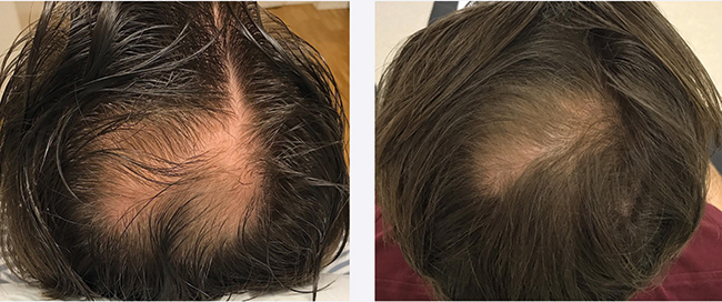 Hair growth and loss prevention training visual