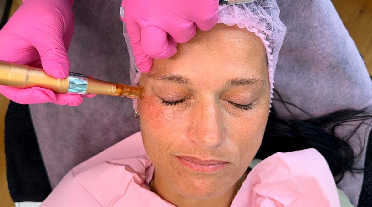 Meso Face Reshape treatment application